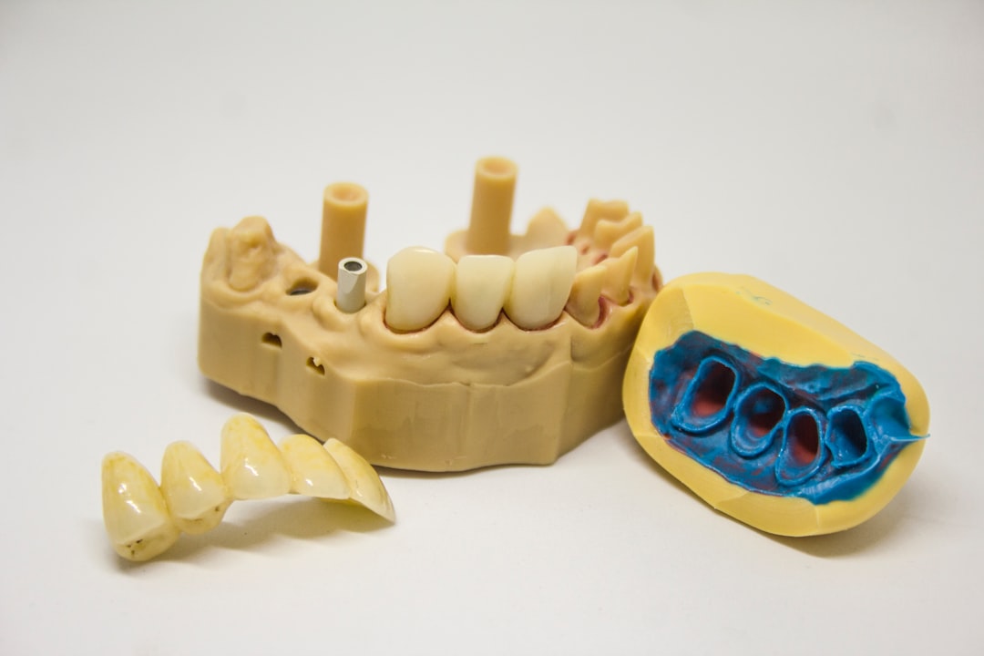 découvrez l'orthodontie pédiatrique, une spécialité dentaire dédiée à la santé bucco-dentaire des enfants. apprenez comment des appareils orthodontiques adaptés aident à corriger les problèmes de malocclusion et à assurer un sourire sain dès le plus jeune âge.